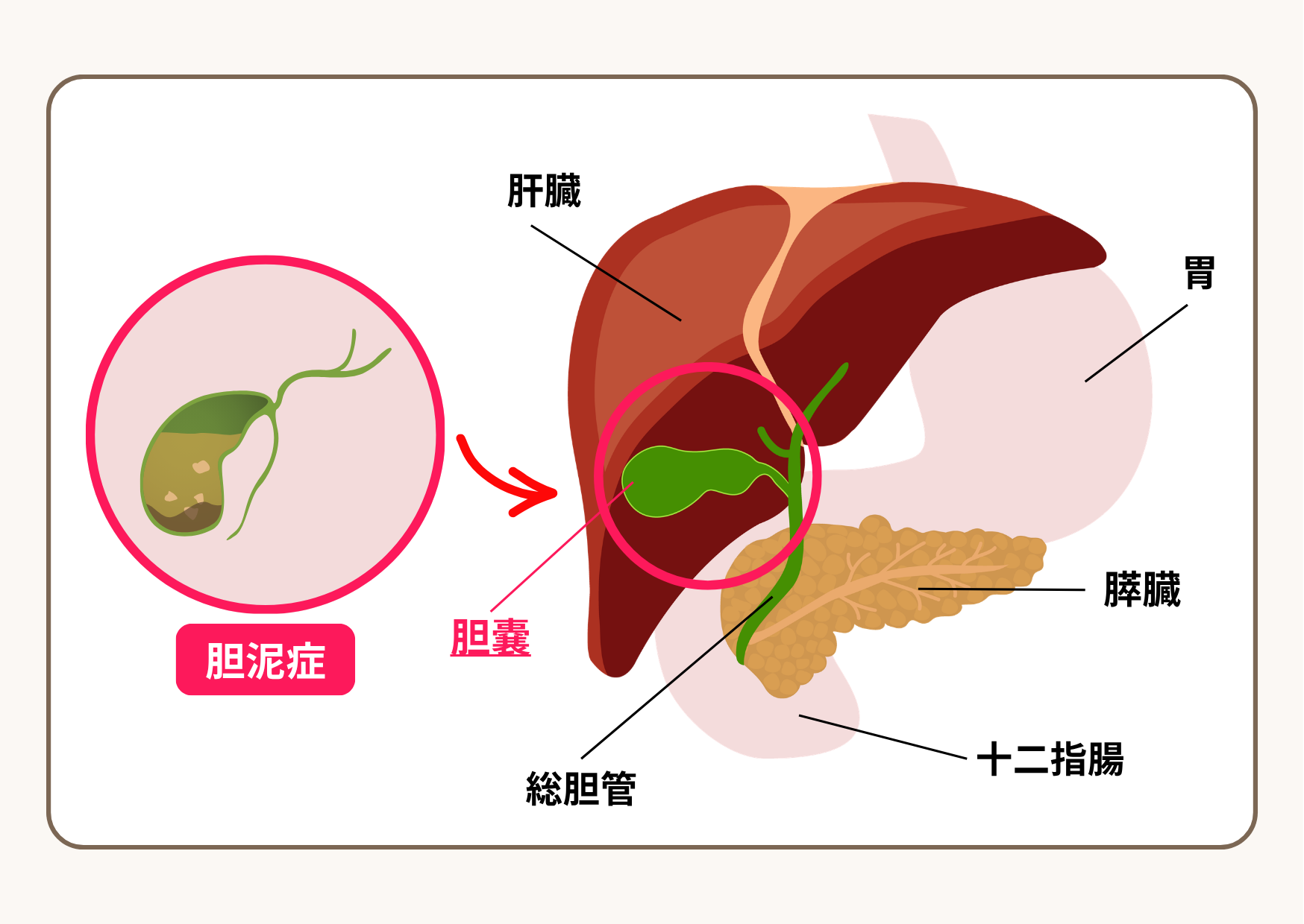 犬や猫の胆泥症と胆嚢の位置を示したイラスト