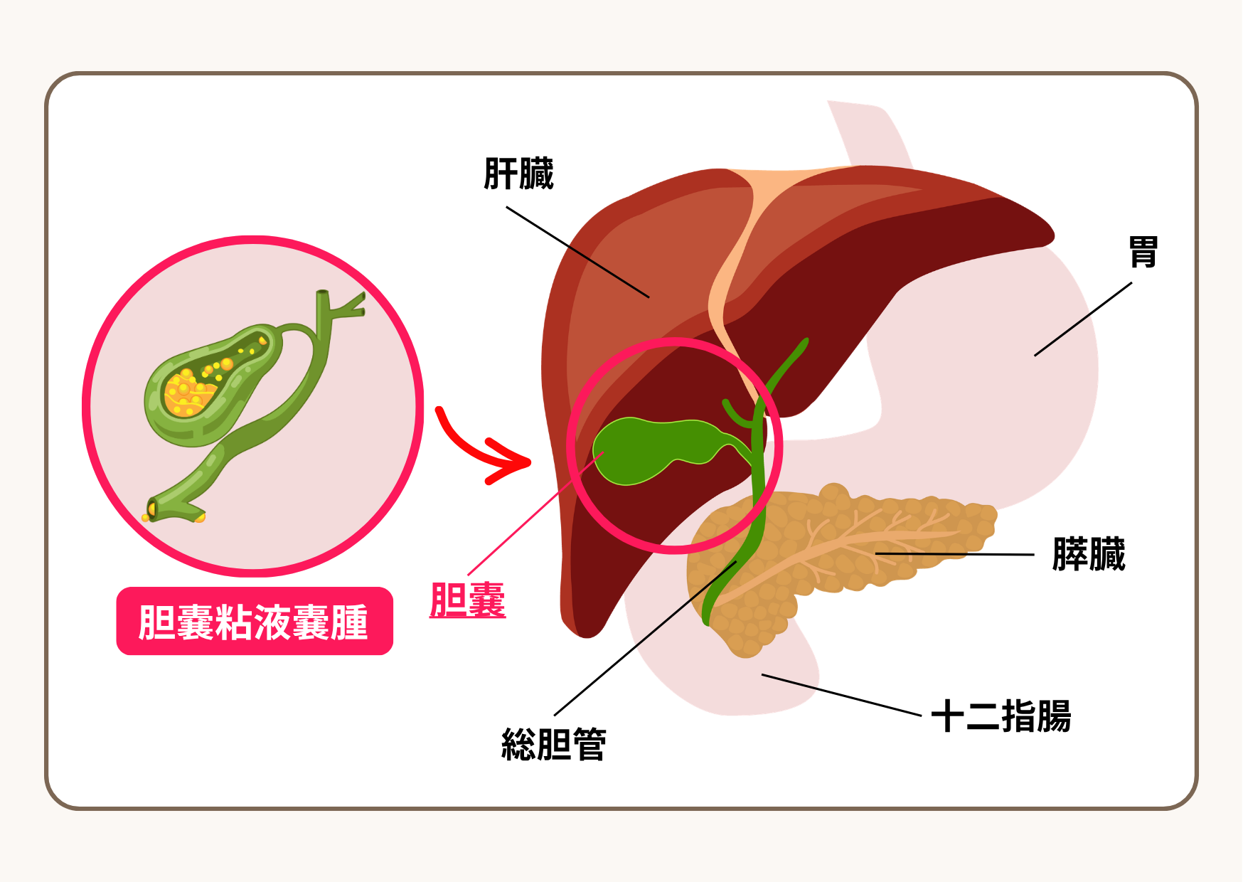 犬の胆嚢粘液嚢腫と胆嚢の位置を示したイラスト